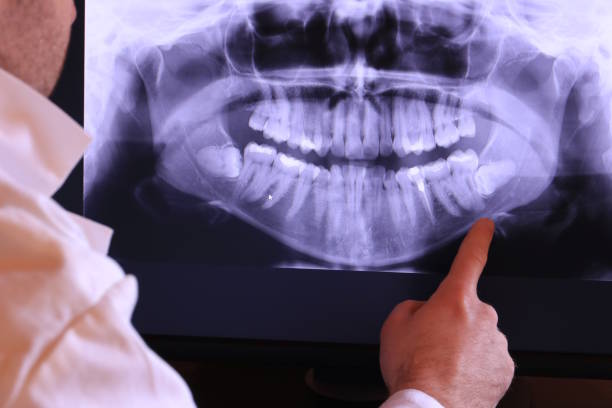 Best Same-Day Emergency Dentist in Dellwood, MN